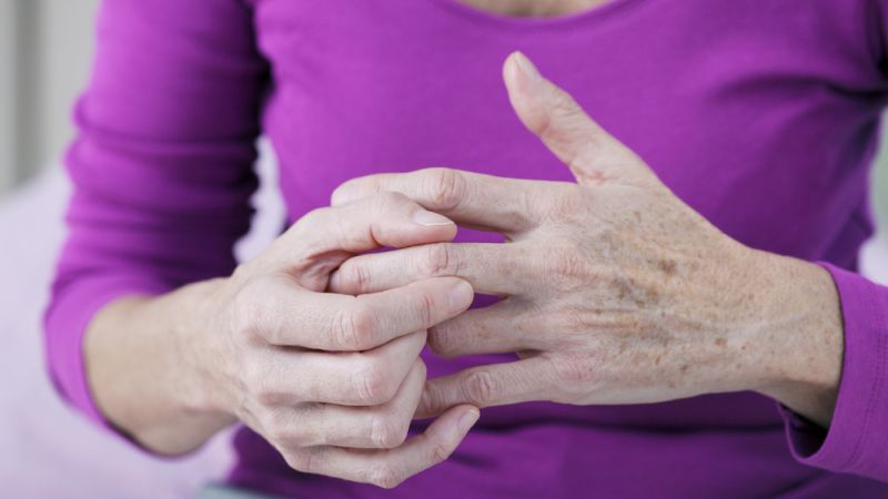 How Arthritis Affects Your Work & Social Life